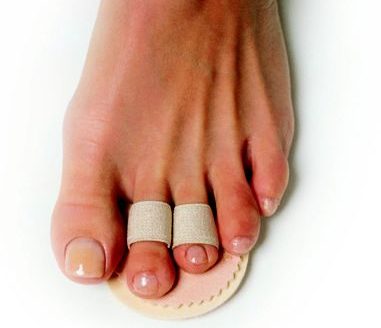 Budin Toe Splint (2 Loops)