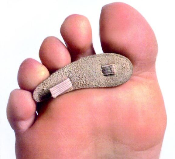 Hammer Toe Crest